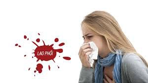 triệu chứng lao phổi
