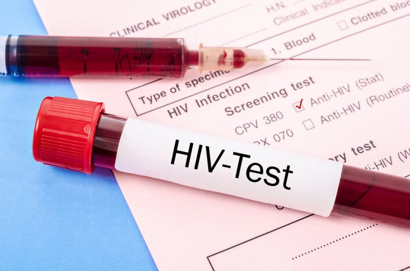 Thời điểm nào xét nghiệm HIV cho kết quả chính xác nhất?