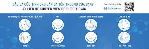 VM Cách chọn kem dưỡng ẩm cho da khô nứt nẻ vào mùa đông