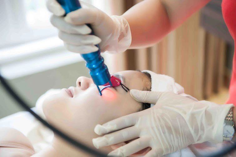 Điều trị bằng laser (laser treatment)