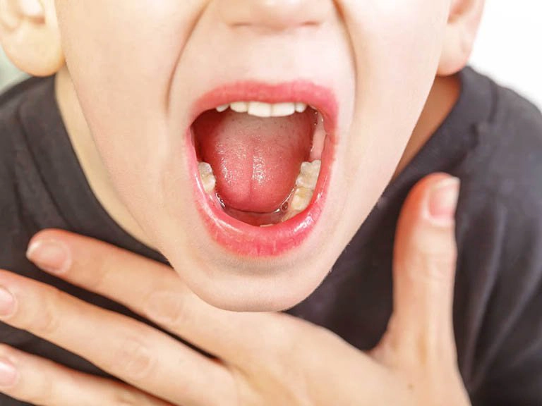 ứ đờm trong cổ họng