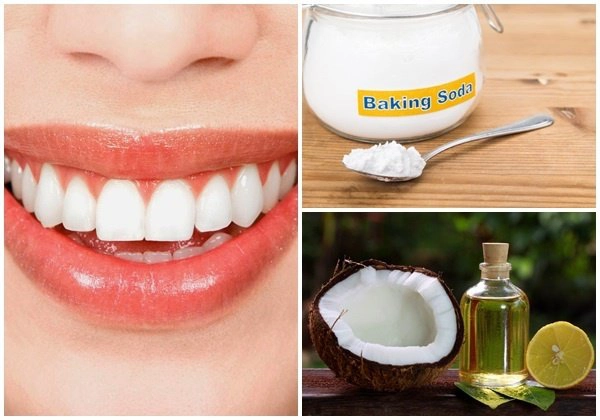 cách loại bỏ đốm đen ở răng