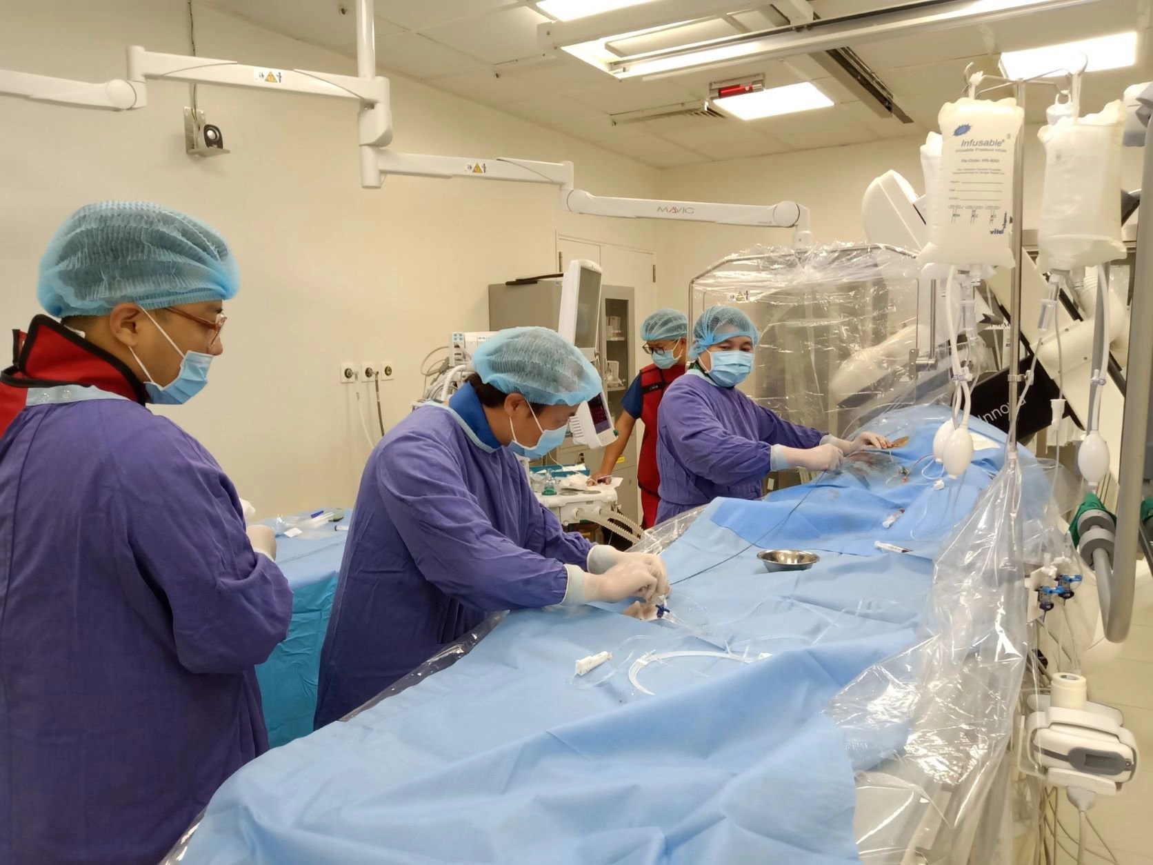 đặt stent cho bệnh nhân phình mạch não