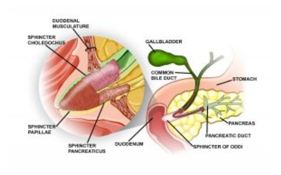 rối loạn chức năng Oddi