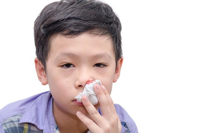 Những sai lầm trong sơ cứu chảy máu cam