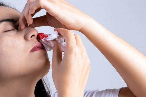 chảy máu cam thiếu chất gì