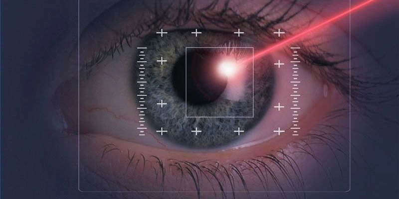 giác mạc như phẫu thuật lasik