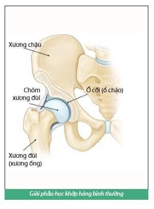 phục hồi chức năng thay khớp háng