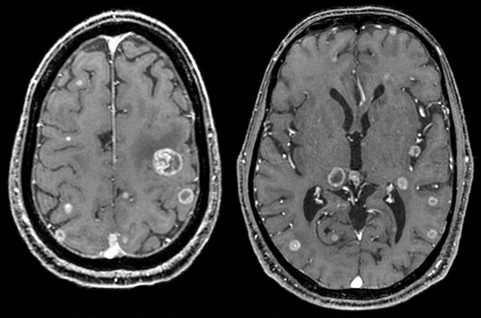 U não CT MRI