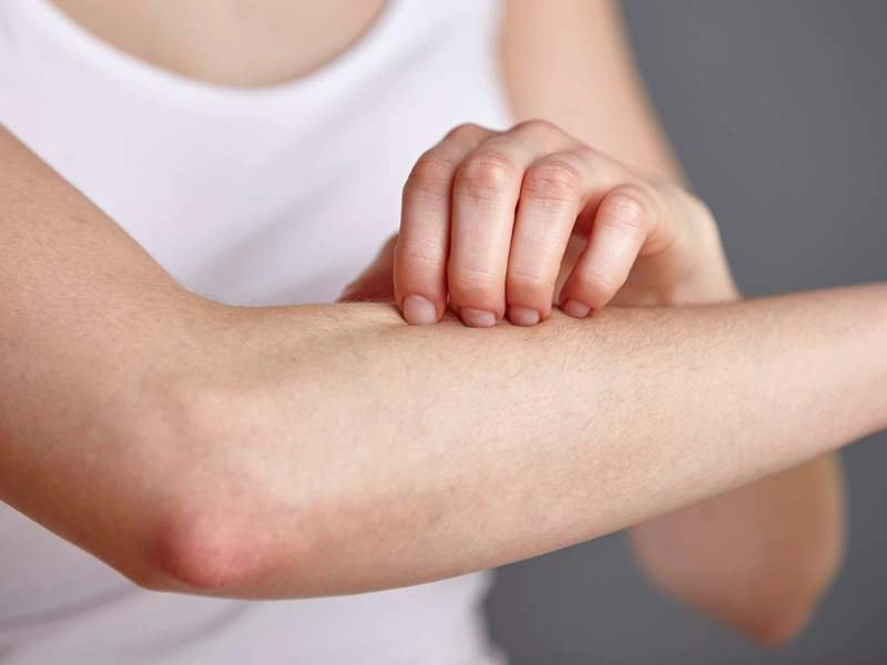 Cơ thể thiếu canxi có thể gây tình trạng ngứa da ở người bệnh