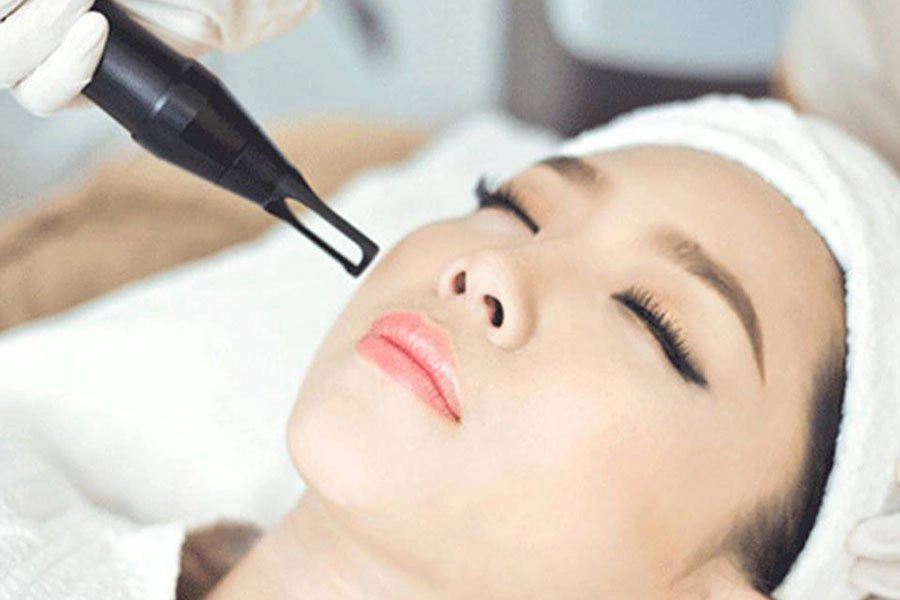 Điều trị u ống tuyến mồ hôi bằng laser