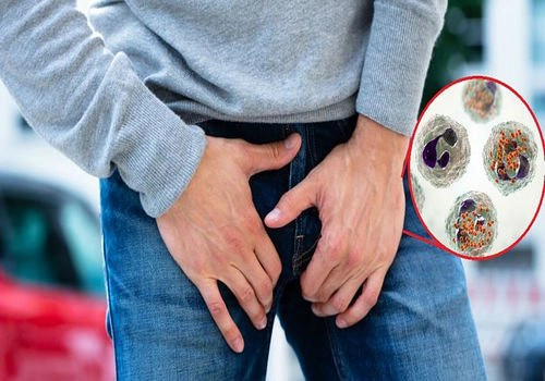 tác hại của bao quy đầu dài