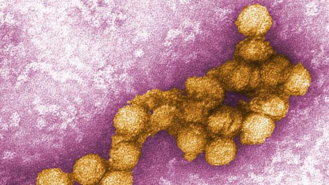 Virus West Nile