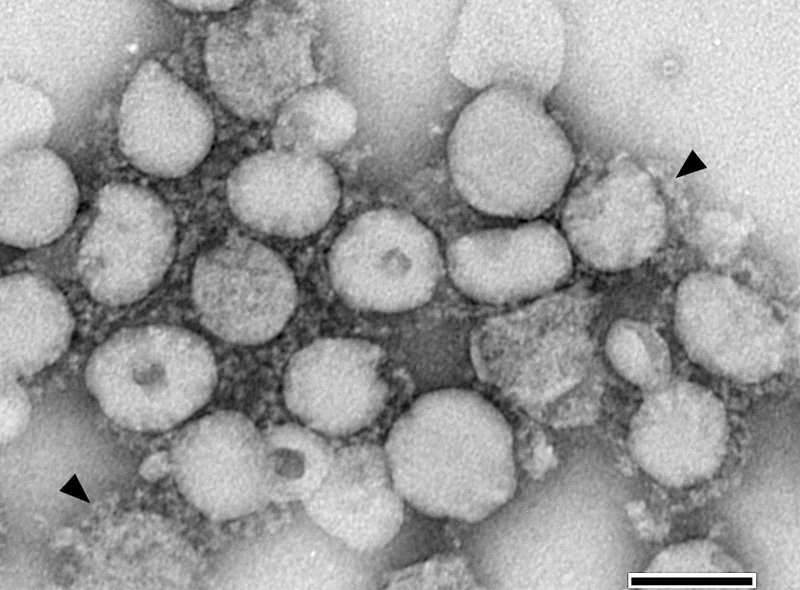 SARS coronavirus (SARS-CoV)