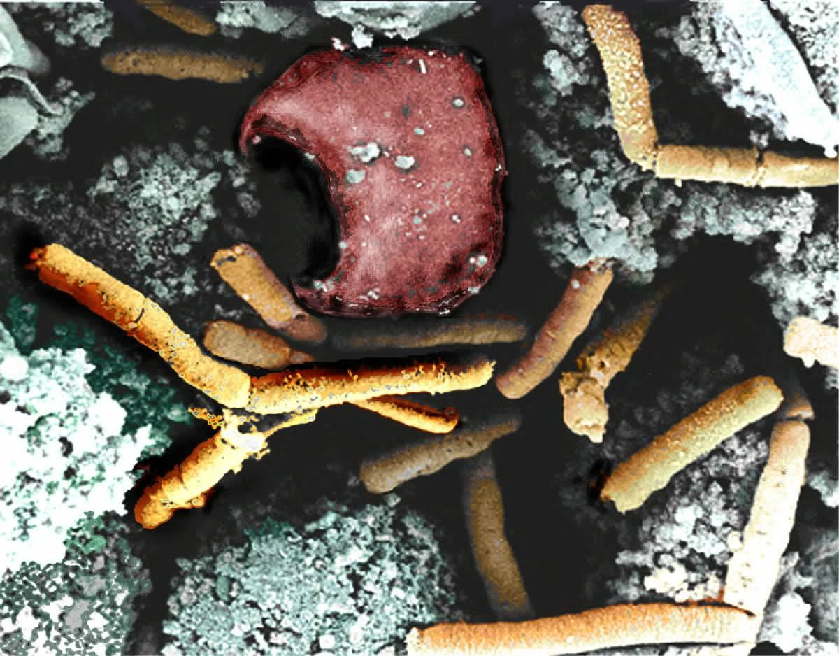 Trực khuẩn than (Bacillus anthracis).