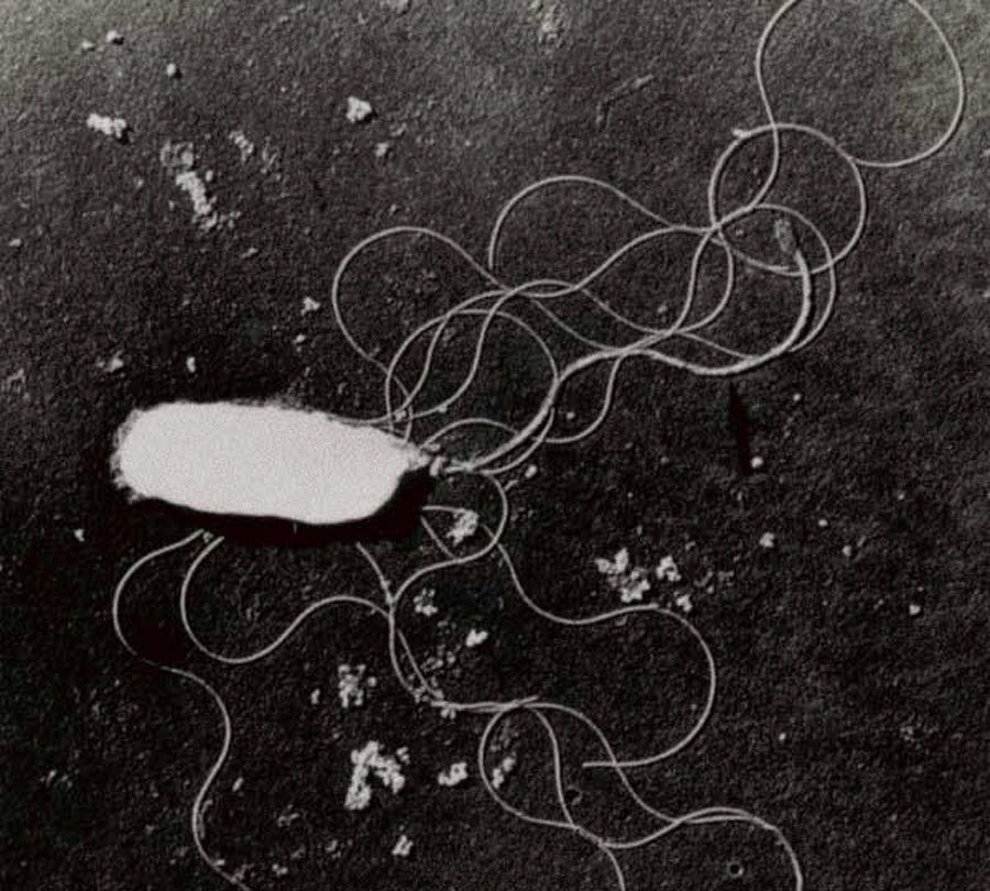 Bệnh viêm ruột do Vibrio Parahaemolyticus