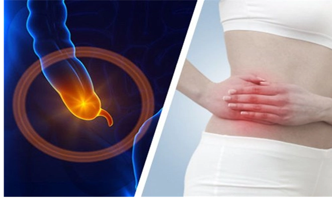 Viêm ruột thừa diễn biến thế nào và kéo dài bao lâu?