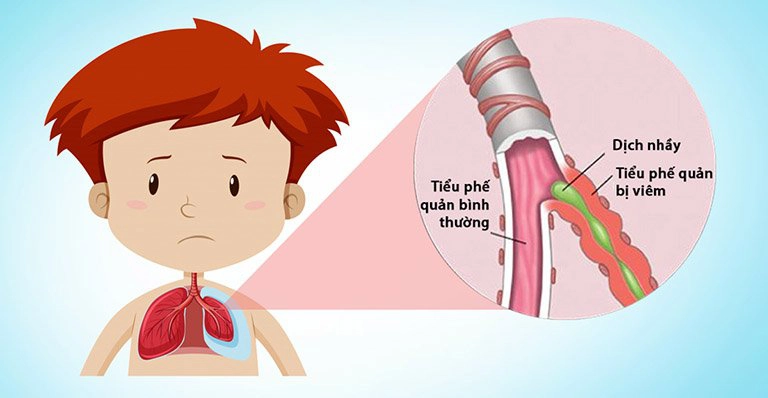 Bé hay ốm khi giao mùa