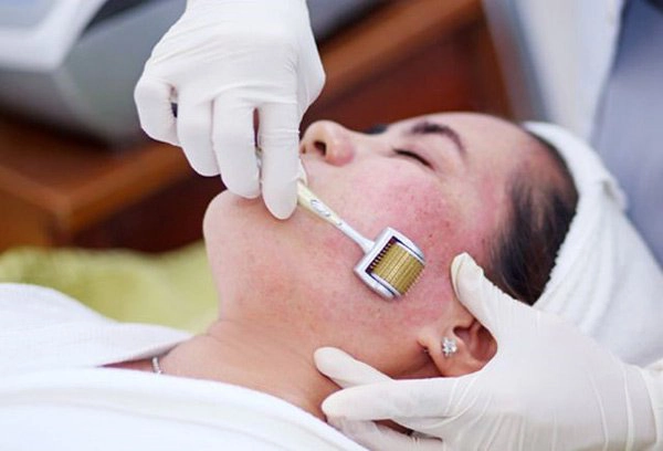 điều trị da nhiễm corticoid
