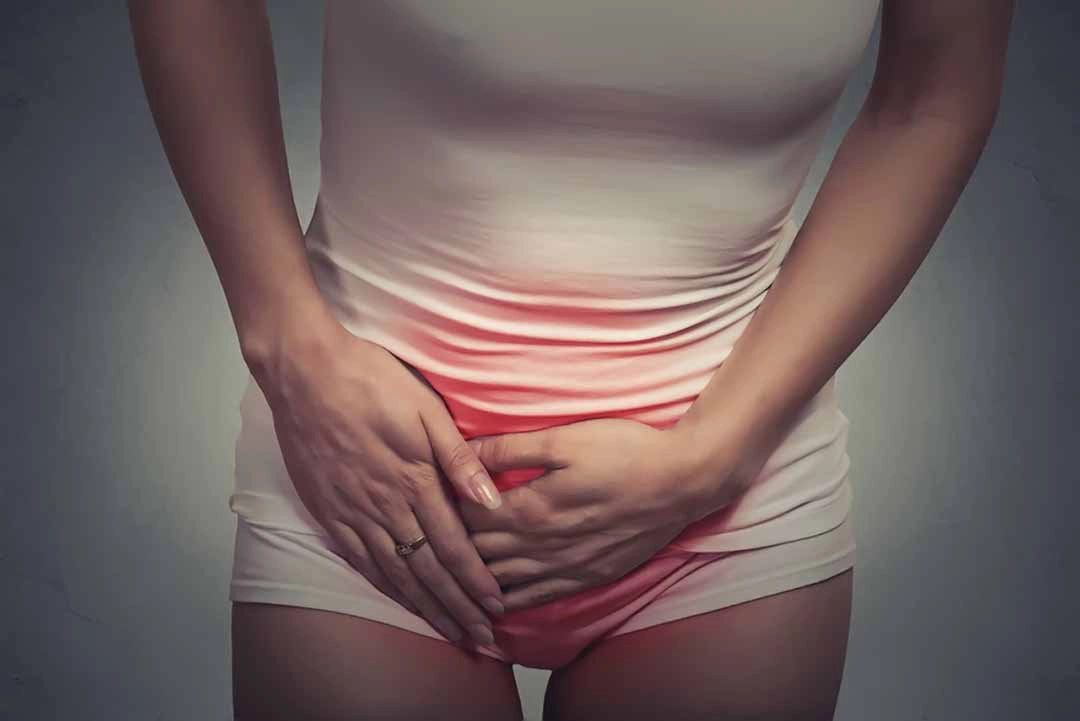 Điều trị nấm Candida tái phát