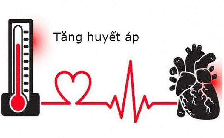 Tăng huyết áp do căng thẳng phải làm thế nào