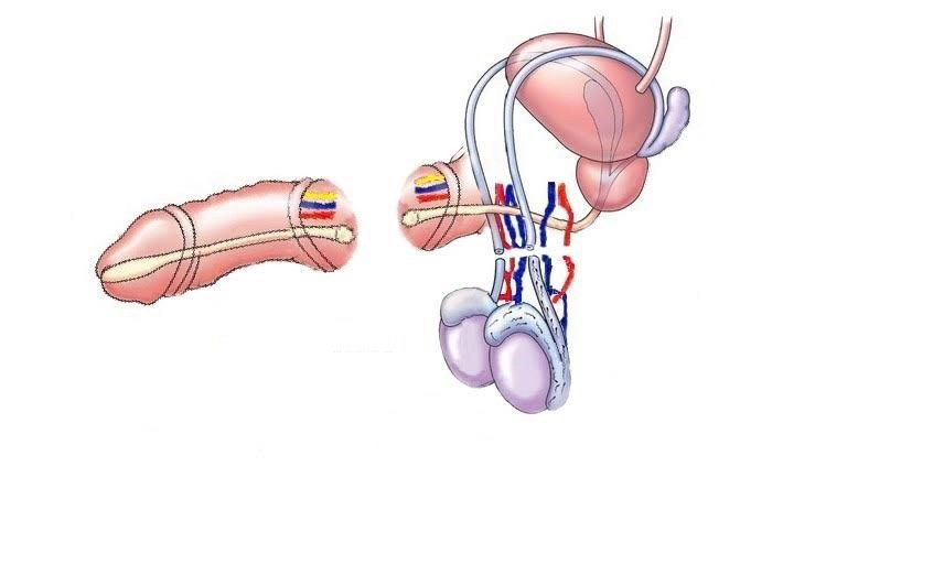 vết thương đứt dương vật