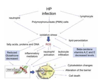 Trình tự sinh bệnh học của nhiễm vi khuẩn Hp làm tăng sản xuất gốc tự do  và các cytokine gây viêm, cho thấy việc tuyển dụng các tế bào bạch cầu khi giảm khả năng phòng thủ chống oxy hóa dẫn đến sự thay đổi của các tế bào niêm mạc dạ dày và do đó của hàng