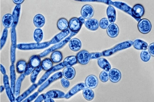 hinh-anh-nam-candida-soi-tuoi (1).png