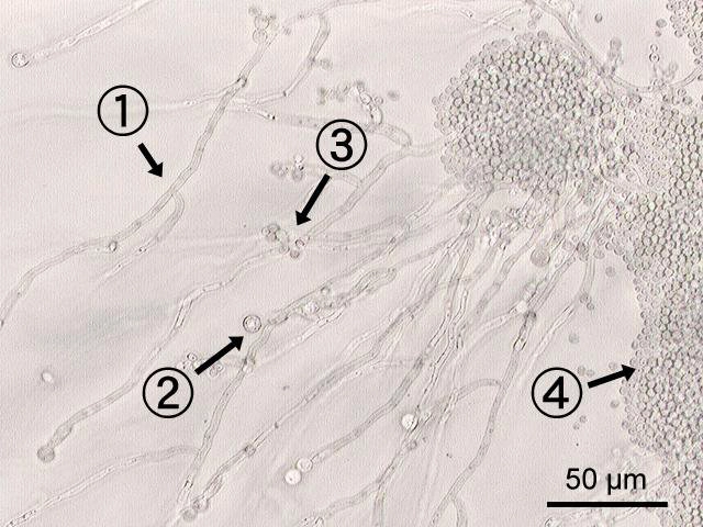 hinh-anh-nam-candida-soi-tuoi (1).jpg