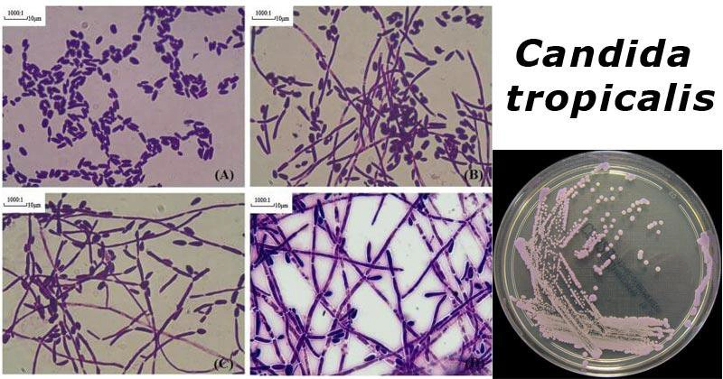 hinh-anh-nam-candida-soi-tuoi (3).jpg