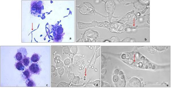 hinh-anh-nam-candida-soi-tuoi (4).jpg
