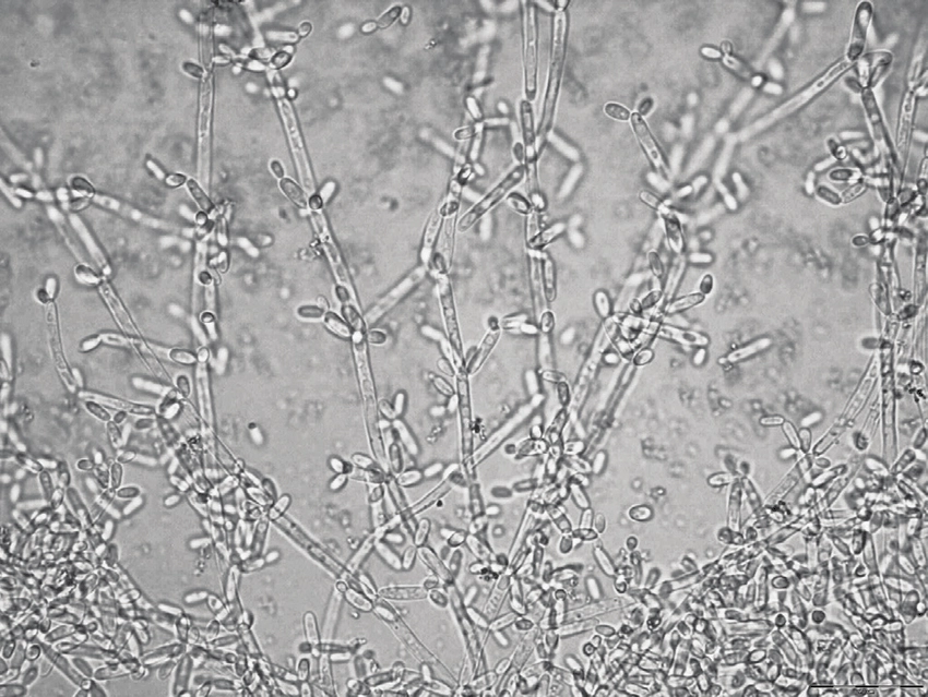 hinh-anh-nam-candida-soi-tuoi (5).png
