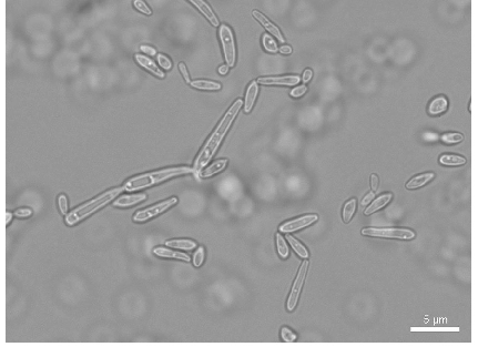 hinh-anh-nam-candida-soi-tuoi (4).png