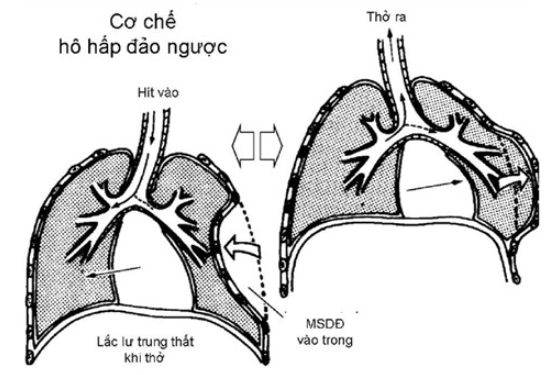Hô hấp đảo ngược