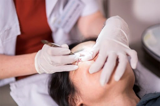 Nếu dị vật kích thước lớn bạn nên nhờ sự trợ giúp từ phía nhân viên y tế để lấy dị vật trong mắt