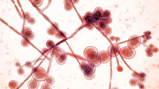 nhiễm nấm candida xâm lấn