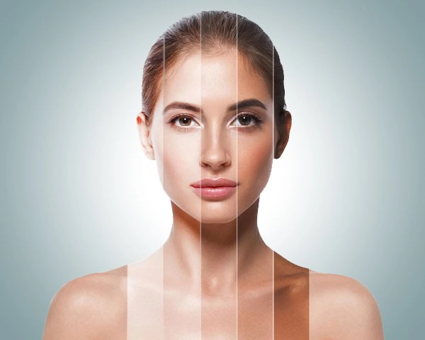 hydroquinone