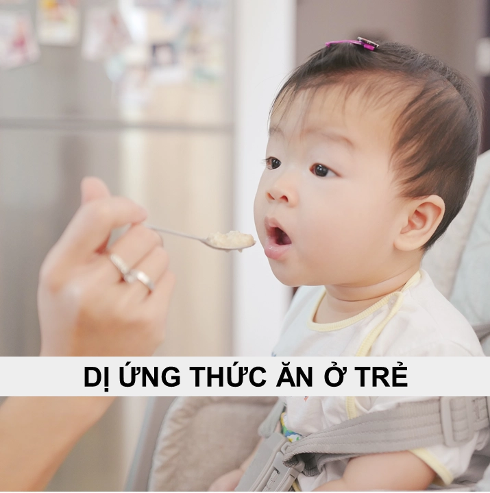 Dị ứng thức ăn ở trẻ