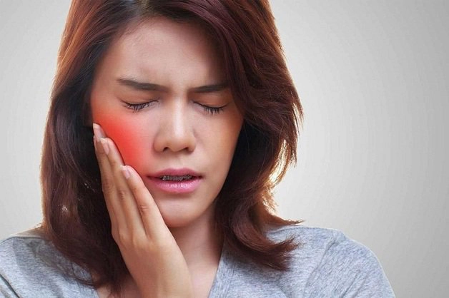 mặt bị sưng phù