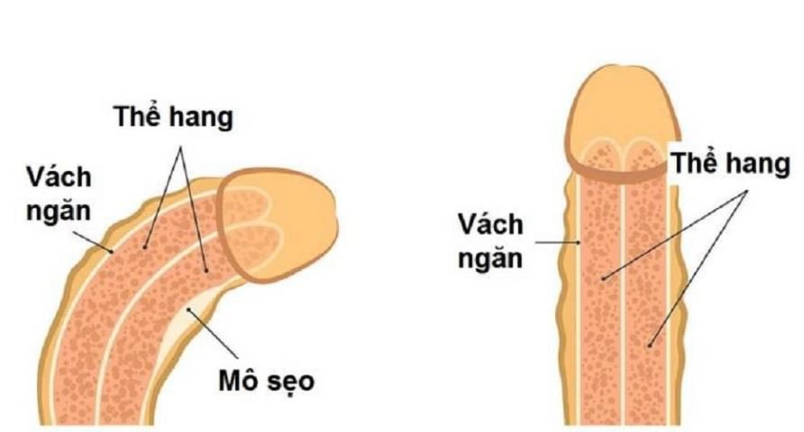 quan hệ xong bị đau buốt ở nam giới