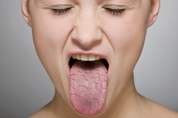 mất vị giác là như thế nào