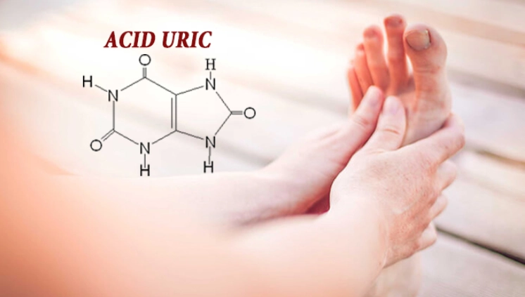 Acit uric