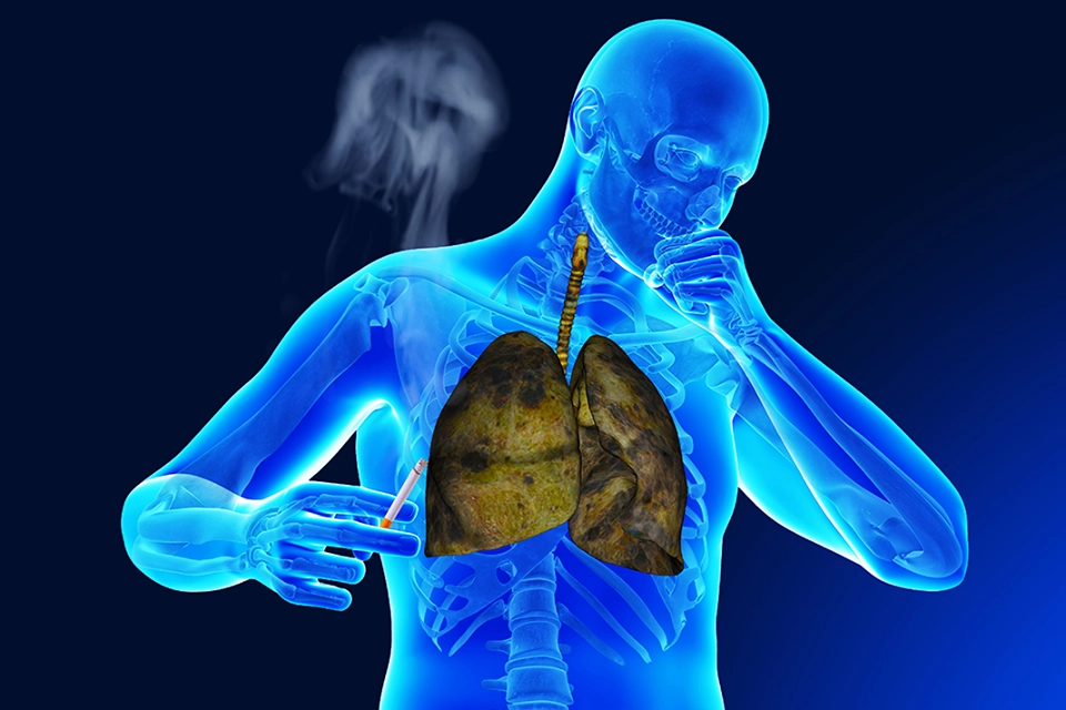 phổi ứ nước