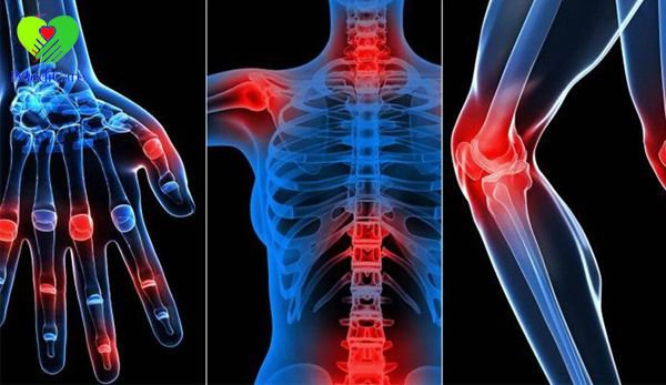 Nữ giới thoái hóa xương khớp điều trị như thế nào?