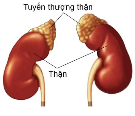 Cắt tuyến thượng thận