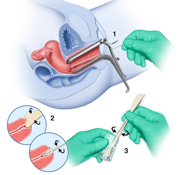 Pap Smear Test