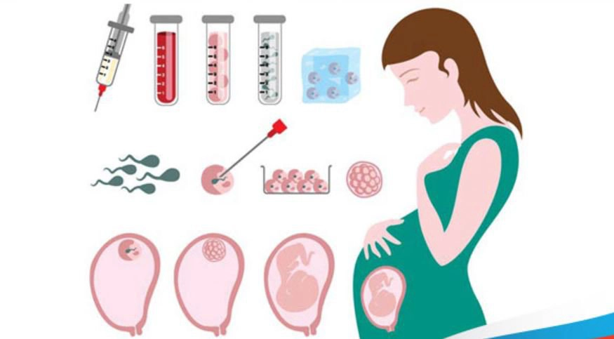 ivf