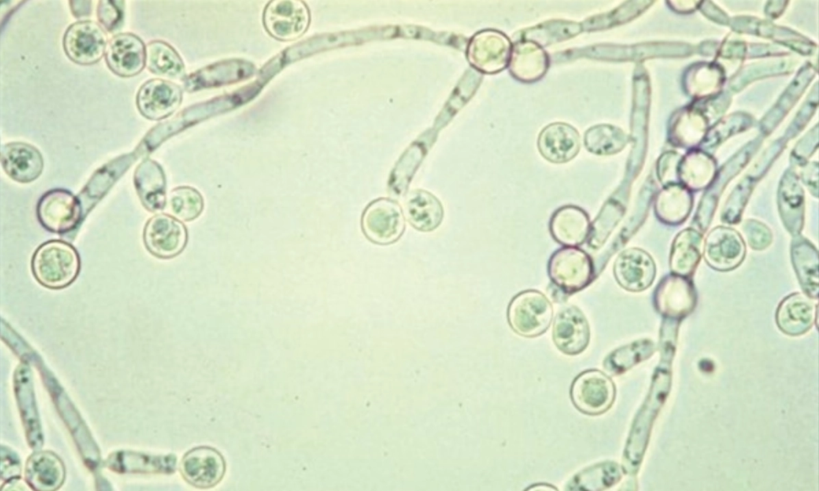 Nấm Candida