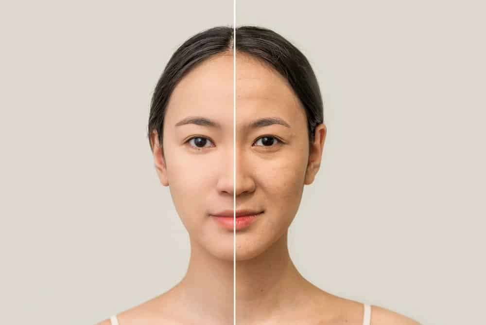 Dị ứng mỹ phẩm