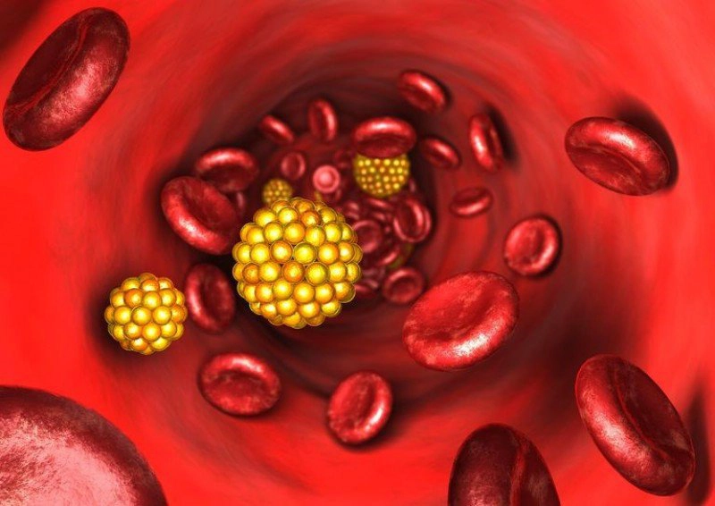 tăng triglycerid máu